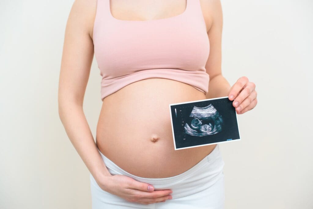cropped shot of pregnant woman with ultrasound scan picture of baby