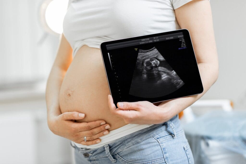 Pregnant woman with ultrasound scan of her baby